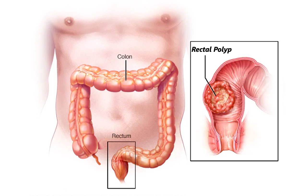Rectum