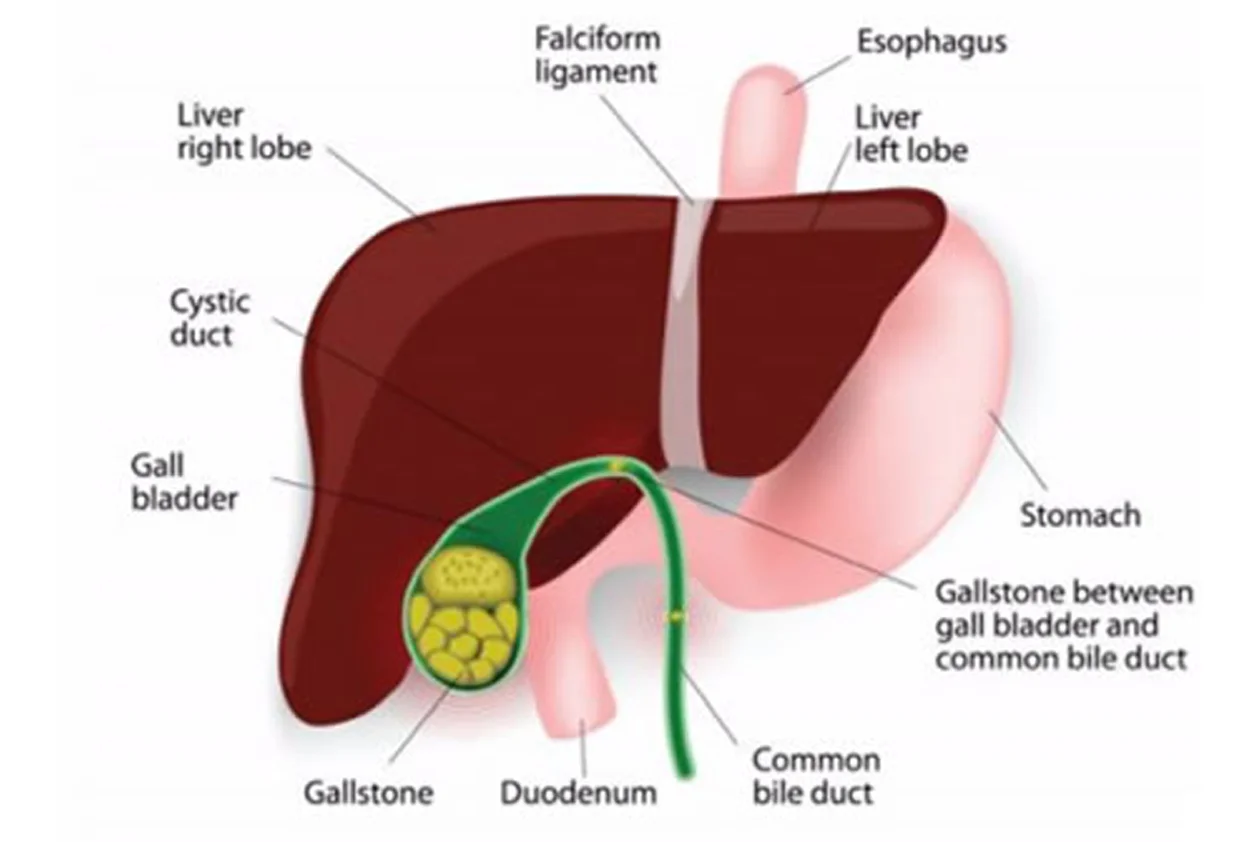 CBD Calculus Surgery